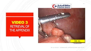 VIDEO 3
RETRIEVALOF
THEAPPENDIX
DR. AL-GAILANI LAPAROSCOPIC APPENDICECTOMY: HOW I DO IT?
36
DR. AL-
GAILANI
 