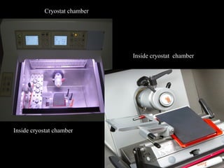Cryostat chamber
Inside cryostat chamber
Inside cryostat chamber
 