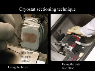 Cryostat sectioning technique
Using the brush
Using the anti
role plate
 