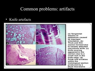 Common problems: artifacts
• Knife artefacts
 