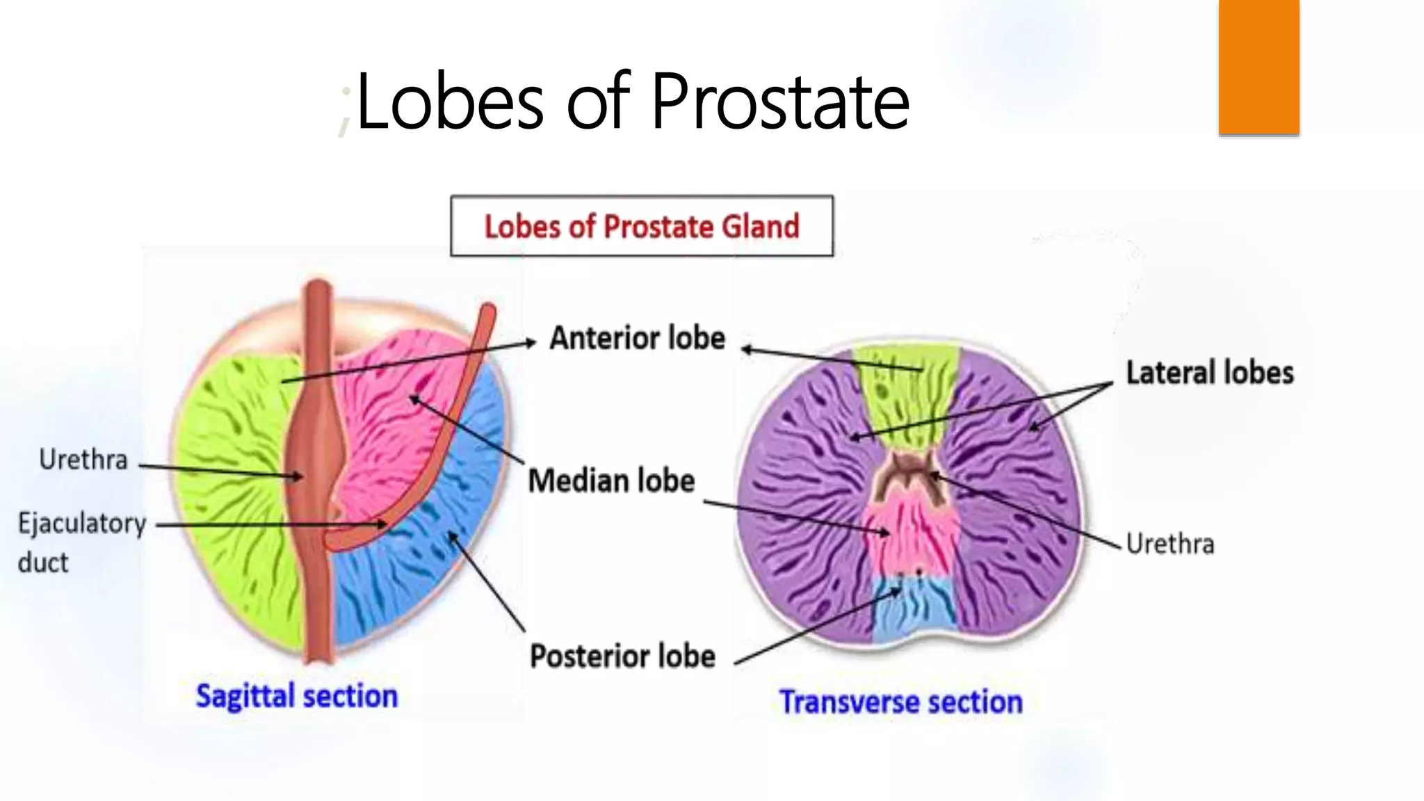 Benign Prostatic Hyperplasia | PPT