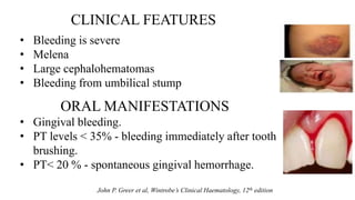 BLEEDING AND CLOTTING DISORDERS | PPTX