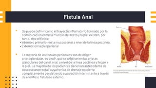Fistula Anal
▪ Se puede definir como el trayecto inflamatorio formado por la
comunicación entre la mucosa del recto y la piel existen, por
tanto, dos orificios:
• Interno o primario: en la mucosa anal a nivel de la línea pectínea.
• Externo: en la piel perianal
▪ La mayoría de las fístulas perianales son de origen
criptoglandular, es decir, que se originan en las criptas
glandulares del canal anal, a nivel de la línea pectínea y llegan a
la piel. La mayoría de los pacientes tienen un antecedente de
absceso anorrectal, cuya herida de drenaje no cierra
completamente persistiendo supuración intermitente a través
de el orificio fistuloso externo.
 