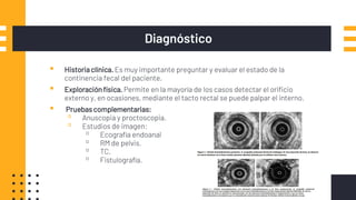 Diagnóstico
▪ Historiaclínica.Es muy importante preguntar y evaluar el estado de la
continencia fecal del paciente.
▪ Exploraciónfísica. Permite en la mayoría de los casos detectar el orificio
externo y, en ocasiones, mediante el tacto rectal se puede palpar el interno.
▪ Pruebascomplementarias:
▫ Anuscopia y proctoscopia.
▫ Estudios de imagen:
▫ Ecografía endoanal
▫ RM de pelvis.
▫ TC.
▫ Fistulografía.
 