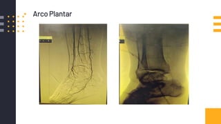 ▪ Arco Plantar
 