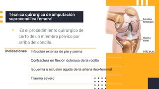 Técnica quirúrgica de amputación
supracondílea femoral
▪ Es el procedimiento quirúrgico de
corte de un miembro pélvico por
arriba del cóndilo.
Indicaciones Infección extensa de pie y pierna
Contractura en flexión dolorosa de la rodilla
Isquemia o oclusión aguda de la arteria ileo-femoral
Trauma severo
 