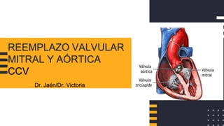 REEMPLAZO VALVULAR
MITRAL Y AÓRTICA
CCV
Dr. Jaén/Dr. Victoria
 