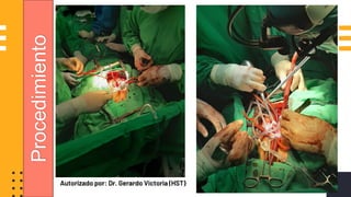 Autorizado por: Dr. Gerardo Victoria (HST)
Procedimiento
 