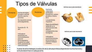 Hechasde tejido
humanoo animal
(bovino,equino,
porcino).
No requierenuso de
anticoagulantes.
Duración10 – 15
año.
Indicadaen
pacientescon
contraindicación
paraser
anticoagulados,
mujerescon edad
fértil,pacientesde
edadavanzada.
Biológicas
Hechade
materiales
artificiales
(sintéticos:carbón
pirolítico,titanio,
etc).
Lospacientes
requieren
anticoagulantesde
porvida.Mayordurabilidady
tasasde no re
intervenciónmás
altasen
comparacióna las
biológicas.
Indicadaen
pacientesjóvenes,
personasqueno
realicentrabajos
forzosos.
Mecánicas
Tipos de Válvulas
A pesarde estoshallazgos,la selecciónde la válvulaprotésicadependede muchosfactoresy
sehade determinaren cadapaciente.
 