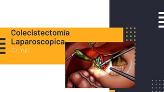 Colecistectomía
Laparoscopica
Dr. Yuil
 