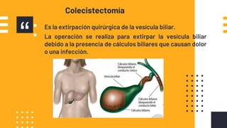 “▪ Es la extirpación quirúrgica de la vesícula biliar.
▪ La operación se realiza para extirpar la vesícula biliar
debido a la presencia de cálculos biliares que causan dolor
o una infección.
Colecistectomía
 