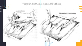 TECLNIACACPERARADRA:OAGUSJACDEVOEREPSSICA
 