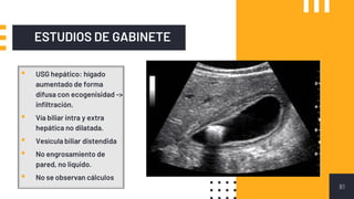 ESTUDIOS DE GABINETE
81
▪ USG hepático: hígado
aumentado de forma
difusa con ecogenisidad ->
infiltración.
▪ Vía biliar intra y extra
hepática no dilatada.
▪ Vesícula biliar distendida
▪ No engrosamiento de
pared, no liquido.
▪ No se observan cálculos
 