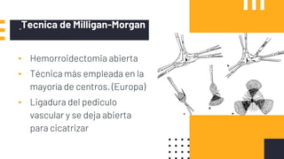 Tecnica de Milligan-Morgan
▪ Hemorroidectomia abierta
▪ Técnica más empleada en la
mayoría de centros. (Europa)
▪ Ligadura del pediculo
vascular y se deja abierta
para cicatrizar
 