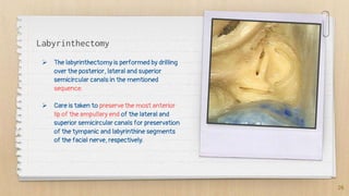 Vestibular schwannoma (acoustic neuroma) surgical anatomy and ...