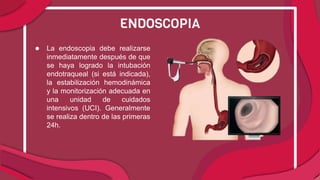 ● La endoscopia debe realizarse
inmediatamente después de que
se haya logrado la intubación
endotraqueal (si está indicada),
la estabilización hemodinámica
y la monitorización adecuada en
una unidad de cuidados
intensivos (UCI). Generalmente
se realiza dentro de las primeras
24h.
ENDOSCOPIA
 