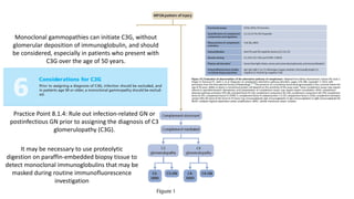 Ig & complement-mediated glomerular dis with MPGN pattern (KDIGO 2021 ...