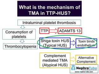 Thrombotic Microangiopathy (TMA) in Adults and Acute Kidney Injury - Dr ...
