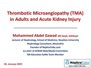Thrombotic Microangiopathy (TMA)
in Adults and Acute Kidney Injury
Mohammed Abdel Gawad MD Neph, ESENeph
Lecturer of Nephrology, School of Medicine, NewGiza University
Nephrology Consultant, Alexandria
Founder of NephroTube.com
Co-chair of AFRAN Web/Media Committee
ISN Education SoMe Team Member
30, January 2023
 