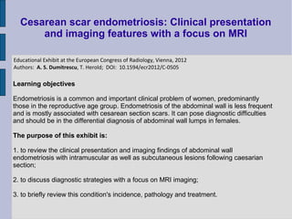 Cesarean scar endometriosis: Clinical presentation
      and imaging features with a focus on MRI

Educational Exhibit at the European Congress of Radiology, Vienna, 2012
Authors: A. S. Dumitrescu, T. Herold; DOI: 10.1594/ecr2012/C-0505

Learning objectives

Endometriosis is a common and important clinical problem of women, predominantly
those in the reproductive age group. Endometriosis of the abdominal wall is less frequent
and is mostly associated with cesarean section scars. It can pose diagnostic difficulties
and should be in the differential diagnosis of abdominal wall lumps in females.

The purpose of this exhibit is:

1. to review the clinical presentation and imaging findings of abdominal wall
endometriosis with intramuscular as well as subcutaneous lesions following caesarian
section;

2. to discuss diagnostic strategies with a focus on MRI imaging;

3. to briefly review this condition's incidence, pathology and treatment.
 