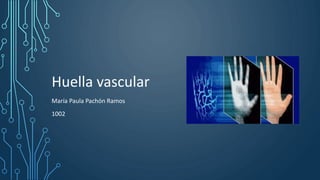Huella vascular
María Paula Pachón Ramos
1002
 