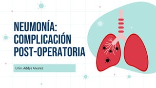 Neumonía:
complicación
post-operatoria
Univ. Addys Alvarez
 