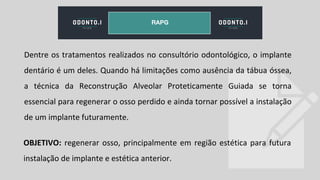 Dentre os tratamentos realizados no consultório odontológico, o implante
dentário é um deles. Quando há limitações como ausência da tábua óssea,
a técnica da Reconstrução Alveolar Proteticamente Guiada se torna
essencial para regenerar o osso perdido e ainda tornar possível a instalação
de um implante futuramente.
OBJETIVO: regenerar osso, principalmente em região estética para futura
instalação de implante e estética anterior.
RAPG
 