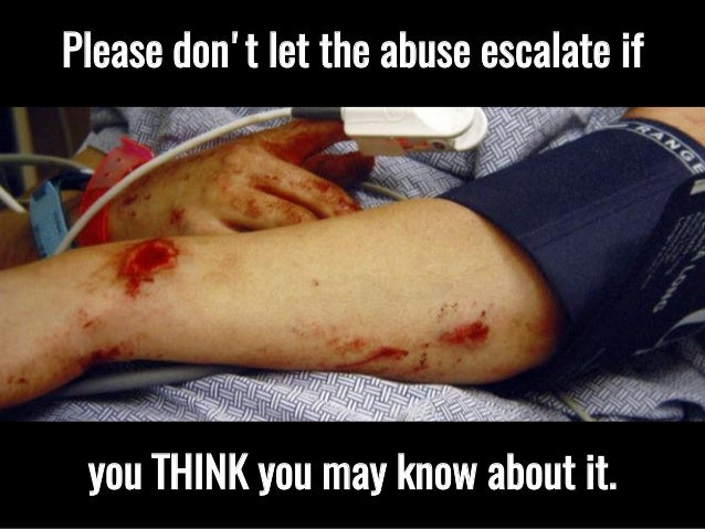 signs of dating abuse Signs of teen dating violence teens who are victims of dating violence are more likely to have problems with school, substance abuse. signs of dating abuse Signs of teen dating violence teens who are victims of dating violence are more likely to have problems with school, substance abuse.