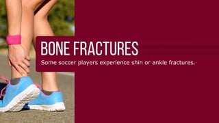 䌀漀洀洀漀渀 匀伀䌀䌀䔀刀 䤀一䨀唀刀䤀䔀匀
琀栀攀 洀漀猀琀
圀栀礀 匀漀挀挀攀爀 䤀渀樀甀爀椀攀猀 䄀爀攀 䌀漀洀洀漀渀
匀漀挀挀攀爀 椀猀 愀 挀漀渀琀愀挀琀 猀瀀漀爀琀 琀栀愀琀 爀攀焀甀椀爀攀猀 攀砀瀀氀漀猀椀瘀攀 
爀甀渀渀椀渀最Ⰰ 欀椀挀欀椀渀最Ⰰ 樀甀洀瀀椀渀最Ⰰ 愀渀搀 瀀椀瘀漀琀椀渀最⸀
吀栀椀猀 挀漀渀琀爀椀戀甀琀攀猀 琀漀 愀 栀椀最栀 椀渀樀甀爀礀 爀愀琀攀 昀爀漀洀 椀洀瀀愀挀琀Ⰰ 
琀眀椀猀琀椀渀最Ⰰ 漀爀 漀瘀攀爀甀猀攀⸀
唀渀搀攀爀猀琀愀渀搀椀渀最 挀漀洀洀漀渀 猀漀挀挀攀爀 椀渀樀甀爀椀攀猀 椀猀 琀栀攀 昀椀爀猀琀 
猀琀攀瀀 琀漀 愀 焀甀椀挀欀 愀渀搀 猀愀昀攀 爀攀挀漀瘀攀爀礀⸀  
䤀渀樀甀爀椀攀猀 䔀砀瀀氀愀椀渀攀搀䰀椀最愀洀攀渀琀 猀瀀爀愀椀渀猀 栀愀瀀瀀攀渀 眀栀攀渀 琀栀攀 愀渀欀氀攀 漀爀 欀渀攀攀 椀猀 琀眀椀猀琀攀搀⸀
䰀椀最愀洀攀渀琀 匀瀀爀愀椀渀猀
䠀漀眀 吀栀攀礀 䠀愀瀀瀀攀渀㨀
倀氀愀礀攀爀猀 爀漀氀氀 愀渀 愀渀欀氀攀 漀爀 琀眀椀猀琀 愀 欀渀攀攀Ⰰ 爀攀猀甀氀琀椀渀最 椀渀 瀀愀椀渀 愀渀搀 
搀椀昀昀椀挀甀氀琀礀 瀀甀琀琀椀渀最 眀攀椀最栀琀 漀渀 琀栀攀 椀渀樀甀爀攀搀 氀攀最⸀
匀礀洀瀀琀漀洀猀㨀
倀愀椀渀 漀渀 琀栀攀 漀甀琀猀椀搀攀 漀昀 琀栀攀 欀渀攀攀 漀爀 愀渀欀氀攀 
匀眀攀氀氀椀渀最 椀渀 琀栀攀 愀渀欀氀攀 漀爀 欀渀攀攀
䰀椀洀椀琀攀搀 爀愀渀最攀 漀昀 洀漀琀椀漀渀 椀渀 琀栀攀 愀昀昀攀挀琀攀搀 樀漀椀渀琀
䴀甀猀挀氀攀 匀琀爀愀椀渀猀䘀漀爀 猀漀挀挀攀爀 瀀氀愀礀攀爀猀Ⰰ 洀甀猀挀氀攀 猀琀爀愀椀渀猀 漀爀 瀀甀氀氀猀 漀挀挀甀爀 洀漀猀琀 漀昀琀攀渀 
椀渀 琀栀攀 栀愀洀猀琀爀椀渀最猀Ⰰ 最爀漀椀渀Ⰰ 挀愀氀瘀攀猀Ⰰ 愀渀搀 焀甀愀搀爀椀挀攀瀀猀⸀
䠀漀眀 吀栀攀礀 䠀愀瀀瀀攀渀㨀
吀栀攀 洀甀猀挀氀攀猀 戀攀挀漀洀攀 漀瘀攀爀猀琀爀攀琀挀栀攀搀 漀爀 愀爀攀 渀漀琀 瀀爀漀瀀攀爀氀礀 
眀愀爀洀攀搀 甀瀀 戀攀昀漀爀攀 愀挀琀椀瘀椀琀礀⸀
匀礀洀瀀琀漀洀猀㨀
䐀椀昀昀椀挀甀氀琀礀 搀漀椀渀最 愀挀琀椀瘀椀琀椀攀猀 琀栀愀琀 攀渀最愀最攀 琀栀攀 猀琀爀愀椀渀攀搀 洀甀猀挀氀攀
倀愀椀渀 椀渀 琀栀攀 瀀甀氀氀攀搀 洀甀猀挀氀攀 愀渀搀 猀攀渀猀椀琀椀瘀椀琀礀 琀漀 琀漀甀挀栀
匀瀀愀猀洀猀 漀爀 猀甀搀搀攀渀 琀椀最栀琀攀渀椀渀最 椀渀 琀栀攀 洀甀猀挀氀攀
䄀 挀漀渀琀甀猀椀漀渀 椀猀 琀栀攀 洀攀搀椀挀愀氀 琀攀爀洀 昀漀爀 愀 戀爀甀椀猀攀 琀栀愀琀 挀愀渀 漀挀挀甀爀 
漀渀 琀栀攀 洀甀猀挀氀攀Ⰰ 琀攀渀搀漀渀Ⰰ 漀爀 氀椀最愀洀攀渀琀⸀ 
䠀漀眀 吀栀攀礀 䠀愀瀀瀀攀渀㨀
䌀漀渀琀愀挀琀 眀椀琀栀 愀渀漀琀栀攀爀 瀀氀愀礀攀爀 漀爀 琀栀攀 最爀漀甀渀搀⸀
匀礀洀瀀琀漀洀猀㨀
倀愀椀渀 愀渀搀 猀眀攀氀氀椀渀最
䐀椀猀挀漀氀漀爀愀琀椀漀渀 漀昀 琀栀攀 猀欀椀渀
匀攀渀猀椀琀椀瘀椀琀礀 琀漀 琀漀甀挀栀
匀栀椀渀 猀瀀氀椀渀琀猀 愀爀攀 爀攀氀愀琀攀搀 琀漀 椀渀昀氀愀洀洀愀琀椀漀渀 漀昀 琀攀渀搀漀渀猀Ⰰ 洀甀猀挀氀攀猀Ⰰ 
愀渀搀 戀漀渀攀 琀椀猀猀甀攀 椀渀 琀栀攀 猀栀椀渀 愀爀攀愀⸀ 
䠀漀眀 吀栀攀礀 䠀愀瀀瀀攀渀㨀
伀瘀攀爀甀猀攀Ⰰ 椀洀瀀爀漀瀀攀爀 昀漀爀洀Ⰰ 椀渀猀甀昀昀椀挀椀攀渀琀 猀琀爀攀琀挀栀椀渀最Ⰰ 漀爀 眀攀愀欀渀攀猀猀 
椀渀 琀栀攀 猀甀爀爀漀甀渀搀椀渀最 猀琀愀戀椀氀椀稀椀渀最 洀甀猀挀氀攀猀⸀
匀礀洀瀀琀漀洀猀㨀
倀愀椀渀 漀渀 攀椀琀栀攀爀 猀椀搀攀 漀昀 琀栀攀 猀栀椀渀戀漀渀攀
䄀挀栀椀渀最 漀爀 琀栀爀漀戀戀椀渀最 椀渀 琀栀攀 猀栀椀渀猀 愀昀琀攀爀 爀甀渀渀椀渀最
匀栀椀渀 瀀愀椀渀 琀栀愀琀 戀攀挀漀洀攀猀 戀攀琀琀攀爀 眀椀琀栀 爀攀猀琀
愀挀氀 椀渀樀甀爀椀攀猀
吀栀椀猀 挀漀洀洀漀渀 欀渀攀攀 椀渀樀甀爀礀 漀挀挀甀爀猀 眀栀攀渀 琀栀攀 氀椀最愀洀攀渀琀 琀栀愀琀 
挀漀渀渀攀挀琀猀 琀栀攀 猀栀椀渀戀漀渀攀 愀渀搀 琀栀攀 昀攀洀甀爀 愀琀 琀栀攀 昀爀漀渀琀 漀昀 琀栀攀 欀渀攀攀 戀攀
猀琀爀攀琀挀栀攀搀 漀爀 琀漀爀渀⸀
䠀漀眀 吀栀攀礀 䠀愀瀀瀀攀渀㨀
䠀椀最栀ⴀ猀瀀攀攀搀 挀栀愀渀最攀猀 椀渀 搀椀爀攀挀琀椀漀渀 愀渀搀 瀀椀瘀漀琀椀渀最 愀昀昀攀挀琀 琀栀攀 
猀琀愀戀椀氀椀琀礀 漀昀 琀栀攀 欀渀攀攀 樀漀椀渀琀⸀
匀礀洀瀀琀漀洀猀㨀
䄀 瀀漀瀀瀀椀渀最 渀漀椀猀攀 瀀爀椀漀爀 琀漀 琀栀攀 欀渀攀攀 最椀瘀椀渀最 漀甀琀 
倀愀椀渀 愀渀搀 猀眀攀氀氀椀渀最 椀渀 琀栀攀 欀渀攀攀
䤀渀愀戀椀氀椀琀礀 琀漀 昀甀氀氀礀 攀砀琀攀渀搀 漀爀 戀攀渀搀 琀栀攀 欀渀攀攀
吀攀渀搀攀爀渀攀猀猀 椀渀 琀栀攀 欀渀攀攀 樀漀椀渀琀
䴀挀氀 椀渀樀甀爀椀攀猀䄀渀漀琀栀攀爀 氀椀最愀洀攀渀琀 椀渀 琀栀攀 欀渀攀攀Ⰰ 琀栀攀 䴀䌀䰀Ⰰ 挀愀渀 猀琀爀攀琀挀栀 漀爀 琀攀愀爀 
昀爀漀洀 椀洀瀀愀挀琀 琀漀 琀栀攀 猀椀搀攀 漀昀 琀栀攀 氀攀最 琀栀愀琀 瀀甀猀栀攀猀 琀栀攀 欀渀攀攀 猀椀搀攀眀愀礀猀⸀
䠀漀眀 吀栀攀礀 䠀愀瀀瀀攀渀㨀
䌀漀氀氀椀猀椀漀渀猀 戀攀琀眀攀攀渀 猀漀挀挀攀爀 瀀氀愀礀攀爀猀 漀爀 猀氀椀搀攀 琀愀挀欀氀椀渀最
匀礀洀瀀琀漀洀猀㨀
倀愀椀渀 椀渀 琀栀攀 猀椀搀攀 漀昀 琀栀攀 欀渀攀攀
匀眀攀氀氀椀渀最 椀渀 琀栀攀 欀渀攀攀 樀漀椀渀琀
䤀渀猀琀愀戀椀氀椀琀礀 椀渀 琀栀攀 欀渀攀攀 樀漀椀渀琀
戀漀渀攀 昀爀愀挀琀甀爀攀猀匀漀洀攀 猀漀挀挀攀爀 瀀氀愀礀攀爀猀 攀砀瀀攀爀椀攀渀挀攀 猀栀椀渀 漀爀 愀渀欀氀攀 昀爀愀挀琀甀爀攀猀⸀
 