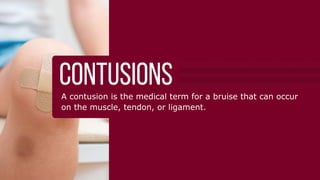 䌀漀洀洀漀渀 匀伀䌀䌀䔀刀 䤀一䨀唀刀䤀䔀匀
琀栀攀 洀漀猀琀
圀栀礀 匀漀挀挀攀爀 䤀渀樀甀爀椀攀猀 䄀爀攀 䌀漀洀洀漀渀
匀漀挀挀攀爀 椀猀 愀 挀漀渀琀愀挀琀 猀瀀漀爀琀 琀栀愀琀 爀攀焀甀椀爀攀猀 攀砀瀀氀漀猀椀瘀攀 
爀甀渀渀椀渀最Ⰰ 欀椀挀欀椀渀最Ⰰ 樀甀洀瀀椀渀最Ⰰ 愀渀搀 瀀椀瘀漀琀椀渀最⸀
吀栀椀猀 挀漀渀琀爀椀戀甀琀攀猀 琀漀 愀 栀椀最栀 椀渀樀甀爀礀 爀愀琀攀 昀爀漀洀 椀洀瀀愀挀琀Ⰰ 
琀眀椀猀琀椀渀最Ⰰ 漀爀 漀瘀攀爀甀猀攀⸀
唀渀搀攀爀猀琀愀渀搀椀渀最 挀漀洀洀漀渀 猀漀挀挀攀爀 椀渀樀甀爀椀攀猀 椀猀 琀栀攀 昀椀爀猀琀 
猀琀攀瀀 琀漀 愀 焀甀椀挀欀 愀渀搀 猀愀昀攀 爀攀挀漀瘀攀爀礀⸀  
䤀渀樀甀爀椀攀猀 䔀砀瀀氀愀椀渀攀搀䰀椀最愀洀攀渀琀 猀瀀爀愀椀渀猀 栀愀瀀瀀攀渀 眀栀攀渀 琀栀攀 愀渀欀氀攀 漀爀 欀渀攀攀 椀猀 琀眀椀猀琀攀搀⸀
䰀椀最愀洀攀渀琀 匀瀀爀愀椀渀猀
䠀漀眀 吀栀攀礀 䠀愀瀀瀀攀渀㨀
倀氀愀礀攀爀猀 爀漀氀氀 愀渀 愀渀欀氀攀 漀爀 琀眀椀猀琀 愀 欀渀攀攀Ⰰ 爀攀猀甀氀琀椀渀最 椀渀 瀀愀椀渀 愀渀搀 
搀椀昀昀椀挀甀氀琀礀 瀀甀琀琀椀渀最 眀攀椀最栀琀 漀渀 琀栀攀 椀渀樀甀爀攀搀 氀攀最⸀
匀礀洀瀀琀漀洀猀㨀
倀愀椀渀 漀渀 琀栀攀 漀甀琀猀椀搀攀 漀昀 琀栀攀 欀渀攀攀 漀爀 愀渀欀氀攀 
匀眀攀氀氀椀渀最 椀渀 琀栀攀 愀渀欀氀攀 漀爀 欀渀攀攀
䰀椀洀椀琀攀搀 爀愀渀最攀 漀昀 洀漀琀椀漀渀 椀渀 琀栀攀 愀昀昀攀挀琀攀搀 樀漀椀渀琀
䴀甀猀挀氀攀 匀琀爀愀椀渀猀䘀漀爀 猀漀挀挀攀爀 瀀氀愀礀攀爀猀Ⰰ 洀甀猀挀氀攀 猀琀爀愀椀渀猀 漀爀 瀀甀氀氀猀 漀挀挀甀爀 洀漀猀琀 漀昀琀攀渀 
椀渀 琀栀攀 栀愀洀猀琀爀椀渀最猀Ⰰ 最爀漀椀渀Ⰰ 挀愀氀瘀攀猀Ⰰ 愀渀搀 焀甀愀搀爀椀挀攀瀀猀⸀
䠀漀眀 吀栀攀礀 䠀愀瀀瀀攀渀㨀
吀栀攀 洀甀猀挀氀攀猀 戀攀挀漀洀攀 漀瘀攀爀猀琀爀攀琀挀栀攀搀 漀爀 愀爀攀 渀漀琀 瀀爀漀瀀攀爀氀礀 
眀愀爀洀攀搀 甀瀀 戀攀昀漀爀攀 愀挀琀椀瘀椀琀礀⸀
匀礀洀瀀琀漀洀猀㨀
䐀椀昀昀椀挀甀氀琀礀 搀漀椀渀最 愀挀琀椀瘀椀琀椀攀猀 琀栀愀琀 攀渀最愀最攀 琀栀攀 猀琀爀愀椀渀攀搀 洀甀猀挀氀攀
倀愀椀渀 椀渀 琀栀攀 瀀甀氀氀攀搀 洀甀猀挀氀攀 愀渀搀 猀攀渀猀椀琀椀瘀椀琀礀 琀漀 琀漀甀挀栀
匀瀀愀猀洀猀 漀爀 猀甀搀搀攀渀 琀椀最栀琀攀渀椀渀最 椀渀 琀栀攀 洀甀猀挀氀攀
䌀漀渀琀甀猀椀漀渀猀䄀 挀漀渀琀甀猀椀漀渀 椀猀 琀栀攀 洀攀搀椀挀愀氀 琀攀爀洀 昀漀爀 愀 戀爀甀椀猀攀 琀栀愀琀 挀愀渀 漀挀挀甀爀 
漀渀 琀栀攀 洀甀猀挀氀攀Ⰰ 琀攀渀搀漀渀Ⰰ 漀爀 氀椀最愀洀攀渀琀⸀ 
 