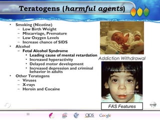 AgingAdulthood
Immunize
Adolescence
Infancy
Erikson
Pregnancy
AinsworthTemperLanguageVygotskyPiaget
ConjoinedTwinsDNAHeredityMethods
Teratogens (harmful agents)
• Smoking (Nicotine)
– Low Birth Weight
– Miscarriage, Premature
– Low Oxygen Levels
– Increase chance of SIDS
• Alcohol
– Fetal Alcohol Syndrome
• Leading cause of mental retardation
• Increased hyperactivity
• Delayed motor development
• Increased depression and criminal
behavior in adults
• Other Teratogens
– Viruses
– X-rays
– Heroin and Cocaine
11
Addiction Withdrawal
FAS Features
 