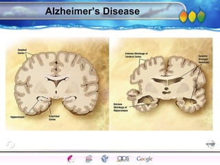 AgingAdulthood
Immunize
Adolescence
Infancy
Erikson
Pregnancy
AinsworthTemperLanguageVygotskyPiaget
ConjoinedTwinsDNAHeredityMethods
Alzheimer’s Disease
 