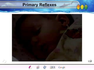 AgingAdulthood
Immunize
Adolescence
Infancy
Erikson
Pregnancy
AinsworthTemperLanguageVygotskyPiaget
ConjoinedTwinsDNAHeredityMethods
Primary Reflexes
 