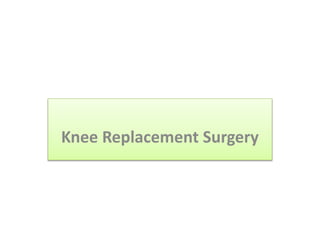 Knee Replacement Surgery
 