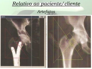 Relativo ao paciente/cliente
Artefatos
 