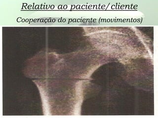 Relativo ao paciente/cliente
Cooperação do paciente (movimentos)
 