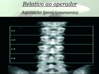 Relativo ao operador
Aquisição (posicionamento)
 