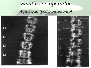 Relativo ao operador
Aquisição (posicionamento)
 