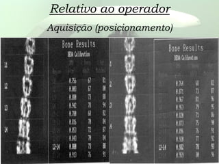 Relativo ao operador
Aquisição (posicionamento)
 