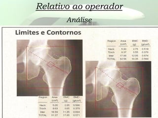 Relativo ao operador
Análise
 