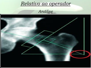 Relativo ao operador
Análise
 