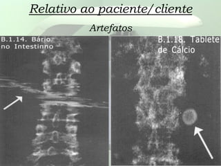 Relativo ao paciente/cliente
Artefatos
 