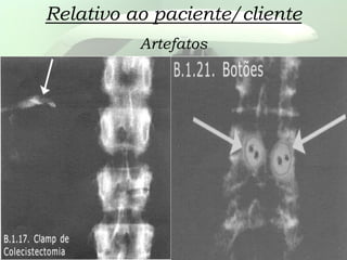 Relativo ao paciente/cliente
Artefatos
 