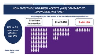 HOW EFFECTIVE IS ULIPRISTAL ACETATE (UPA) COMPARED TO
LEVONORGESTREL (LNG)
55 with no
intervention
23 with LNG 9 with UPA
UPA is 2.5
times more
effective
than LNG
Glasier A et al. Lancet
2010
Pregnancy rates per 1000 women in the first 24 hours after unprotected sex
 