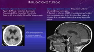 IMPLICACIONES CLÍNICAS
Obstrucción o Agenesia del Conducto Ventricular:
• Agujero de Monro: Hidrocefalia Biventricular
• Acueducto de Silvio: Hidrocefalia Triventricular
• Agujeros del IV ventrículo: Hidrocefalia Tetraventricular
Cefalea por hipotensión Licuoral (tras punción lumbar o
intervención neuroquirúrgica).
Al disminuir el volumen del LCR, el 4v desaparece y el cerebro
tiene menos suspensión dentro del cráneo. Esto provoca la
irritación de la meninge en el punto de arranque de médula
espinal.
 