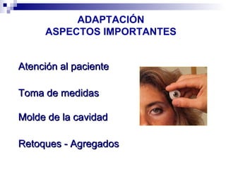 ADAPTACIÓN
ASPECTOS IMPORTANTES
Atención al paciente
Toma de medidas
Molde de la cavidad
Retoques - Agregados

 