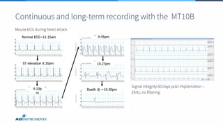 Continuous and long-term recording with the MT10B
Mouse ECG during heart attack
Signal integrity 60 days post implantation –
2kHz, no filtering
 
