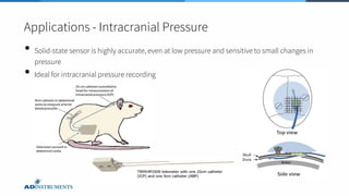 Applications - Intracranial Pressure
• Solid-state sensor is highly accurate, even at low pressure and sensitive to small changes in
pressure
• Ideal for intracranial pressure recording
 