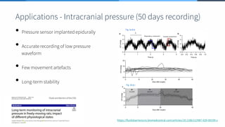 Fig. 2b & c
Fig. 5a & b
https://fluidsbarrierscns.biomedcentral.com/articles/10.1186/s12987-020-00199-z
• Pressure sensor implanted epidurally
• Accurate recording of low pressure
waveform
• Few movement artefacts
• Long-term stability
Applications - Intracranial pressure (50 days recording)
 