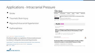 Applications - Intracranial Pressure
• Stroke
• Traumatic Brain Injury
• Migraine/Intracranial Hypertension
• Hydrocephalus
 